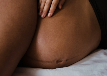 schwangerer bauch der auf der Seite liegt